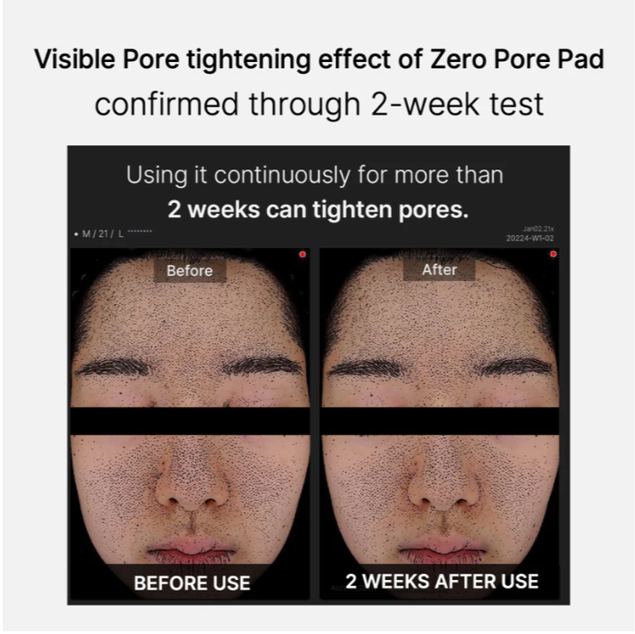 Medicube Zero Pore Pad